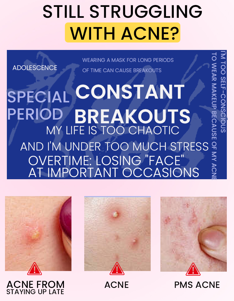OEM Hydrocolloid Pimple Patch