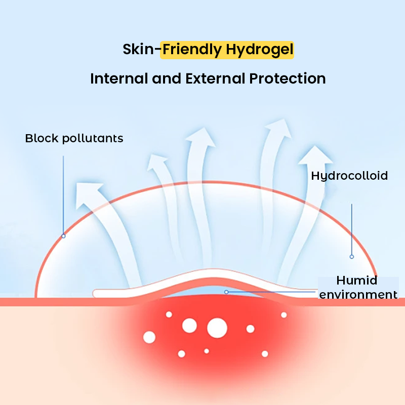 OEM Hydrocolloid Pimple Patch for Acne & Blemish Care | Private Label / Bulk Wholesale